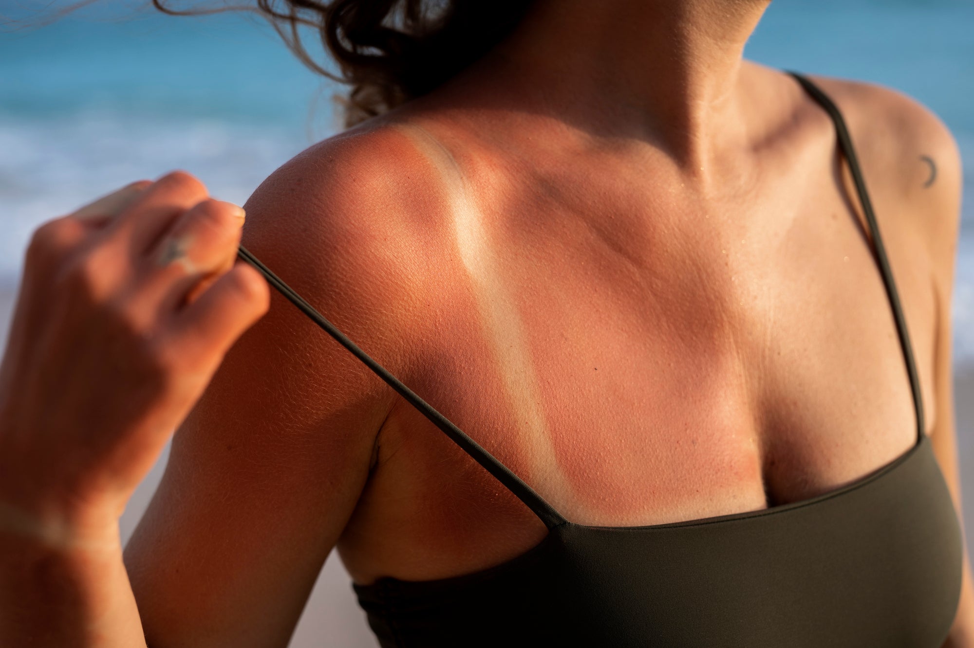 Miniguida alla cura della pelle prima e dopo l’esposizione al sole