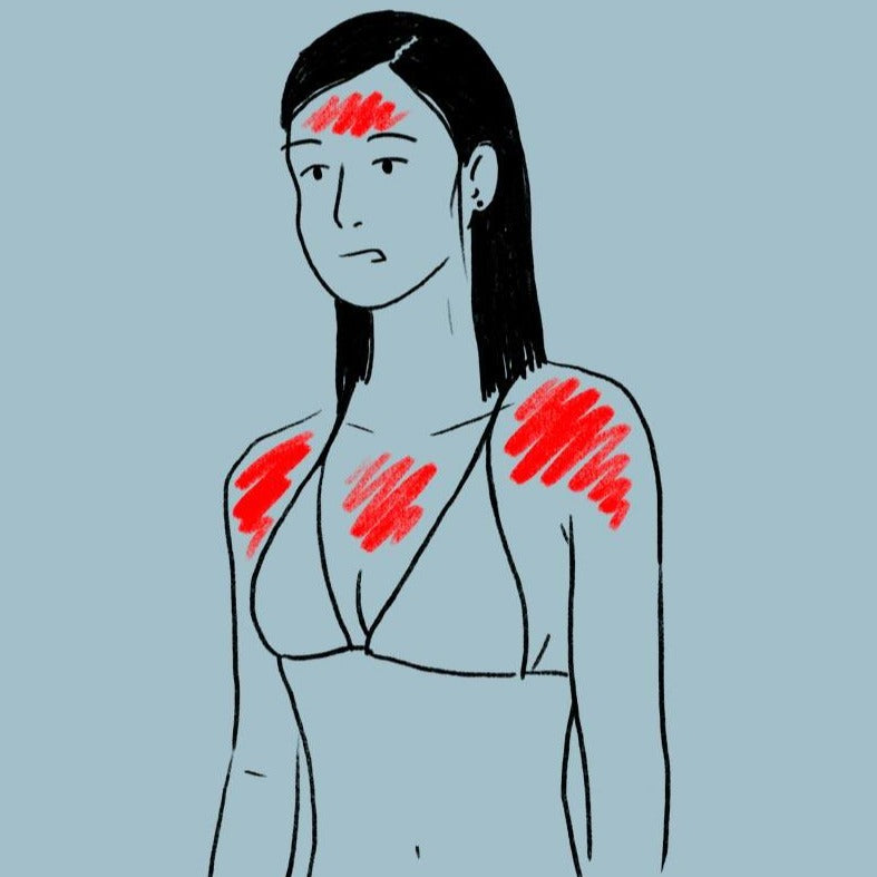 Recovery Spray, lenitivo per Pelle arrossata - Farmacia Dobbiaco